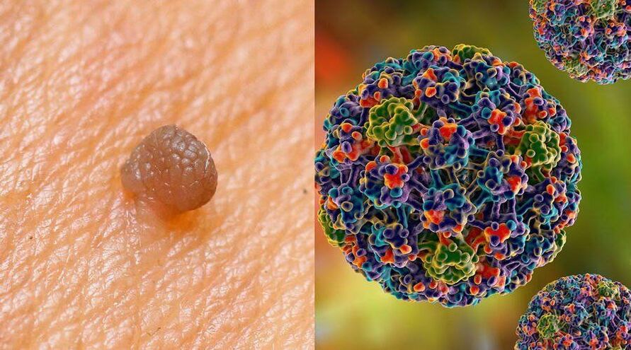 Putevi prijenosa HPV-a